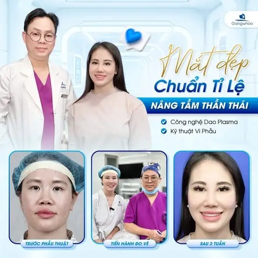 Lấy mỡ mí mắt nội soi - Lấy lại nét đẹp thanh xuân chỉ sau 45 phút