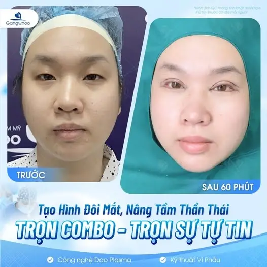 Đôi mắt bồ câu long lanh - Hút mọi ánh nhìn