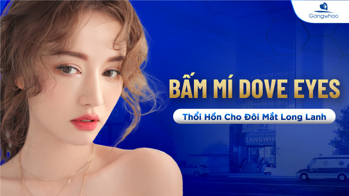 Bấm Mí Dove Eyes, Thổi Hồn Cho Đôi Mắt Long Lanh (Hot Trend 2023)