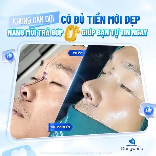 Dáng mũi đẹp chuẩn tỉ lệ vàng cho nam giới.