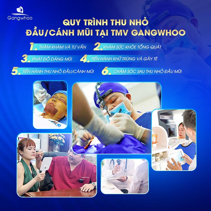 Quy trình thu nhỏ cánh mũi tại TMV Gangwhoo