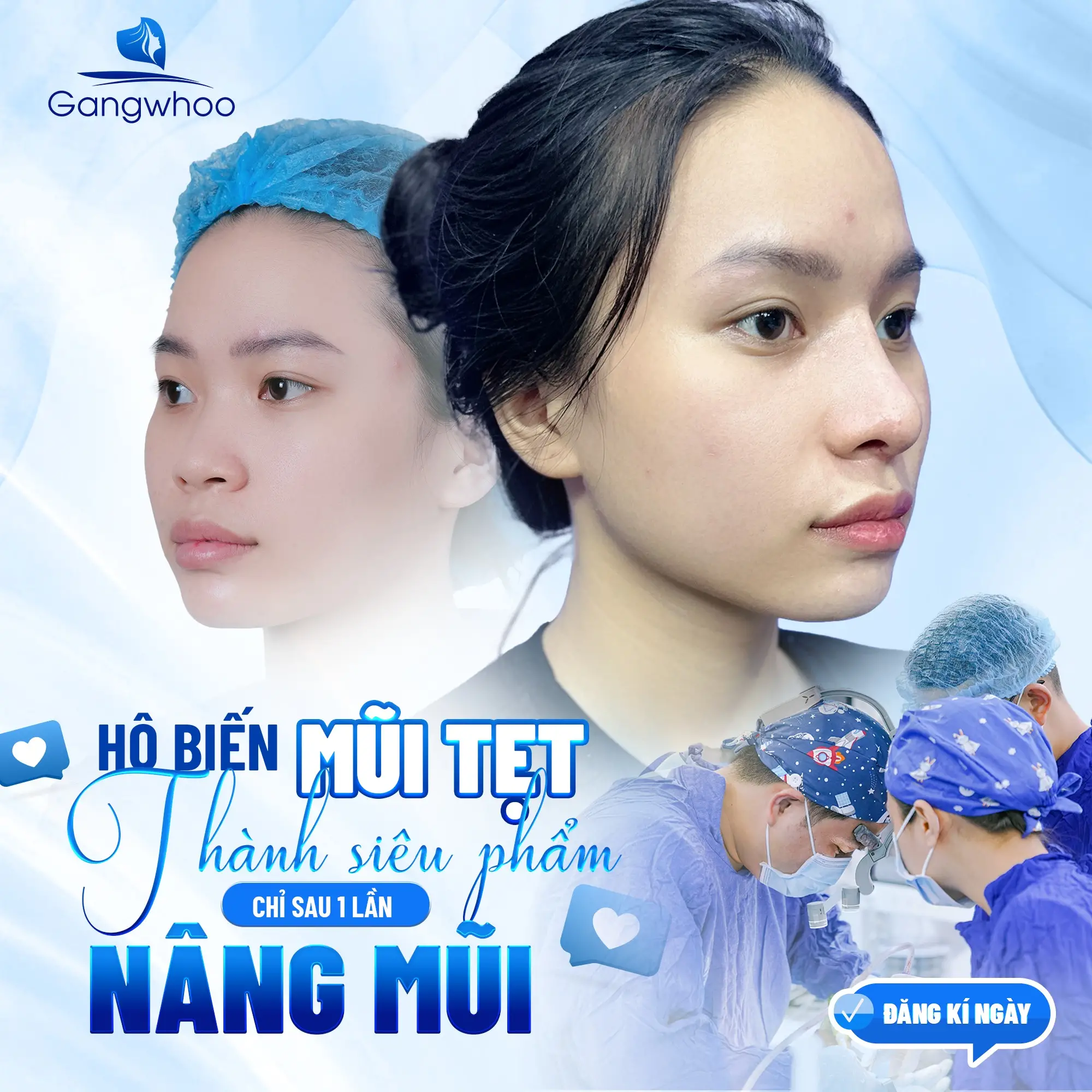 Nâng Mũi Bọc Sụn Tự Thân – Giải Pháp Cho Dáng Đẹp Hài Hòa