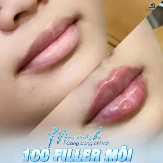 Tạo hình môi trái tim giá ựu đãi chỉ có tại TMV Gangwhoo