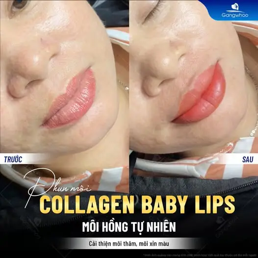 Tạo môi cười là kỹ thuật tạo hình khoé miệng cười thành hình cánh cung