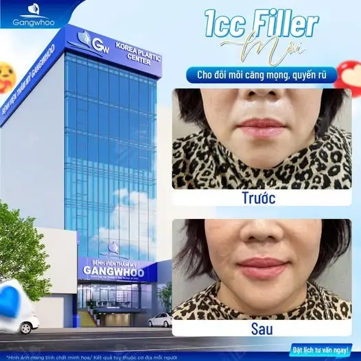 Tạo khóe môi cười - Xinh tựa hotgirl