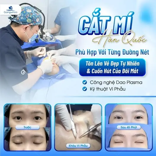 Cắt Mí Hàn Quốc Đẹp Chuẩn "Sao Hàn" Xu Thế Mí Mắt Mới