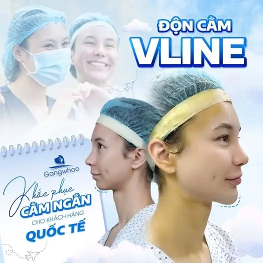 Độn cằm Korea Implant cải thiện đáng kể đến hình dạng của toàn gương mặt