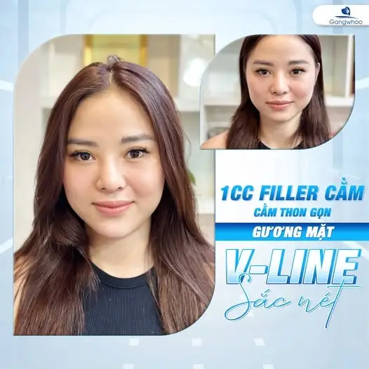 Phản hồi tích cực của khách hàng "nhà" Gangwhoo