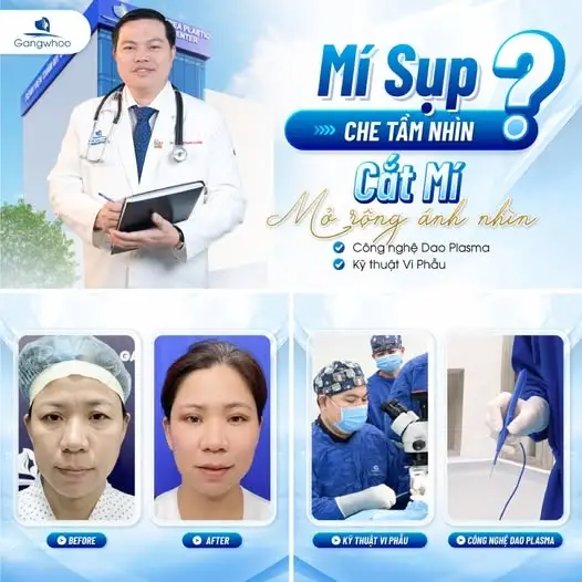 Sụp mí bẩm sinh là một chứng bệnh thường gặp