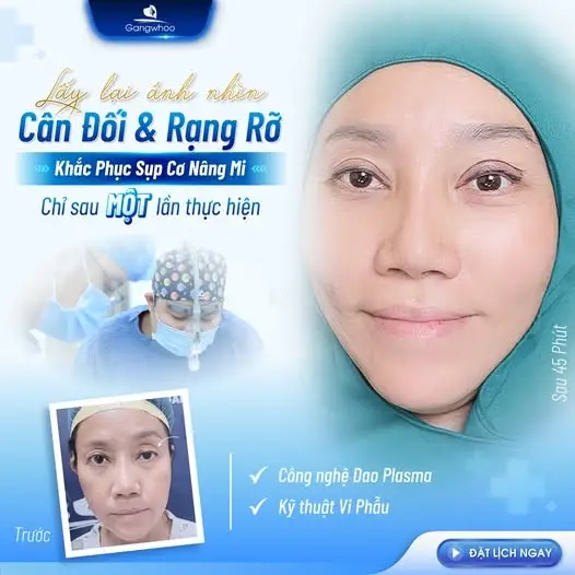 TMV Gangwhoo mang lại tầm nhìn cho khách hàng