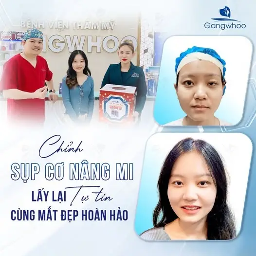Chữa sụp mí bẩm sinh càng sớm càng tốt