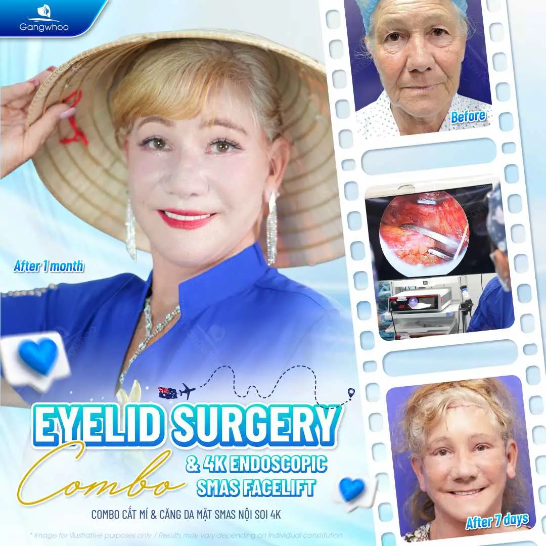 Hướng dẫn cách chăm sóc sau khi căng da mặt