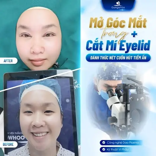 Ưu đãi hấp dẫn chỉ có tại TMV Gangwhoo