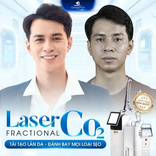 Trị dứt điểm sẹp rỗ sau 1 liệu trình 