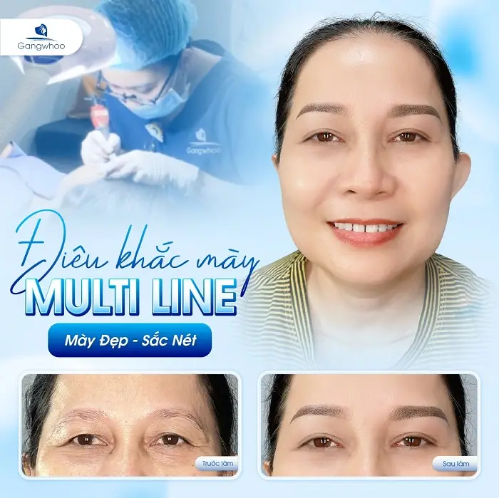 Cách chăm sóc sau khi thực hiện điêu khắc chân mày
