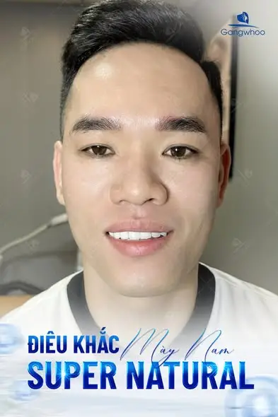 Có nên điêu khắc chân mày nam hay không do nhu cầu, mong muốn, quan niệm cá nhân của mỗi người.