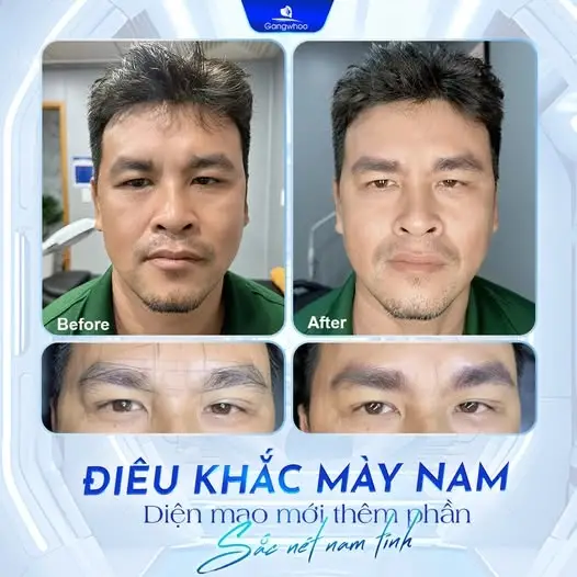 Điêu khắc chân mày là phương pháp làm đẹp phổ biến hiện nay