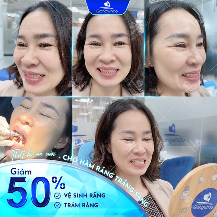 Ưu đãi lên đến 50% khi thực hiện từ 2 dịch vụ răng hàm mặt tại TMV Gangwhoo