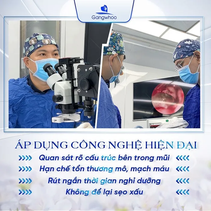 Luôn áp dụng công nghệ máy móc hiện đại trong nâng mũi