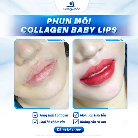 Loại bỏ môi thâm, tự tin tỏa sáng