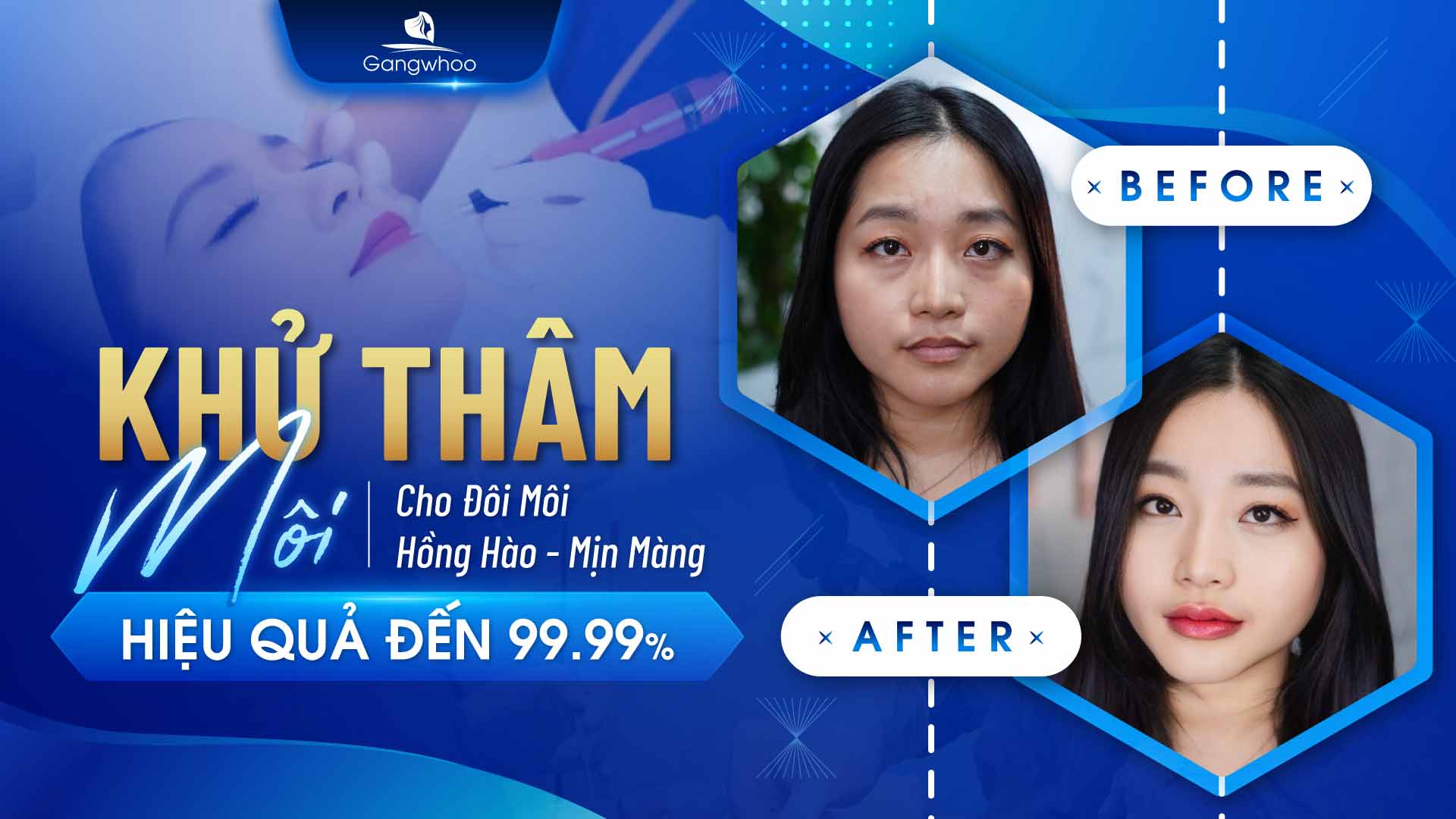 Một đôi môi hồng hào và căng mọng sẽ khiến chúng ta tự tin hơn mỗi khi ra đường