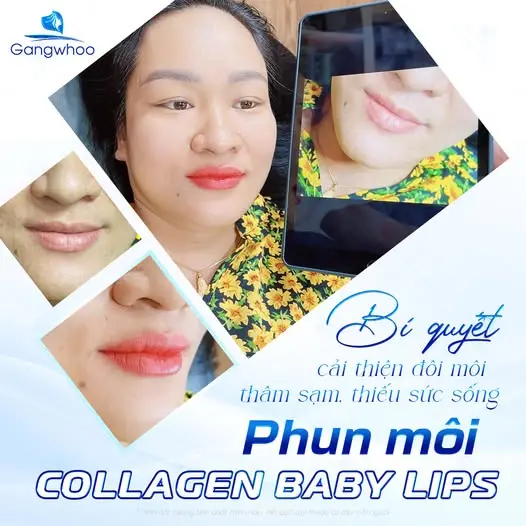 Chỉ với 30 phút tình trạng môi thâm của bạn sẽ được cải thiện đáng kể