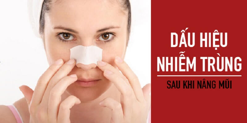 chăm sóc sau khi nâng mũi tốt để tránh bị nhiễm trùng mũi