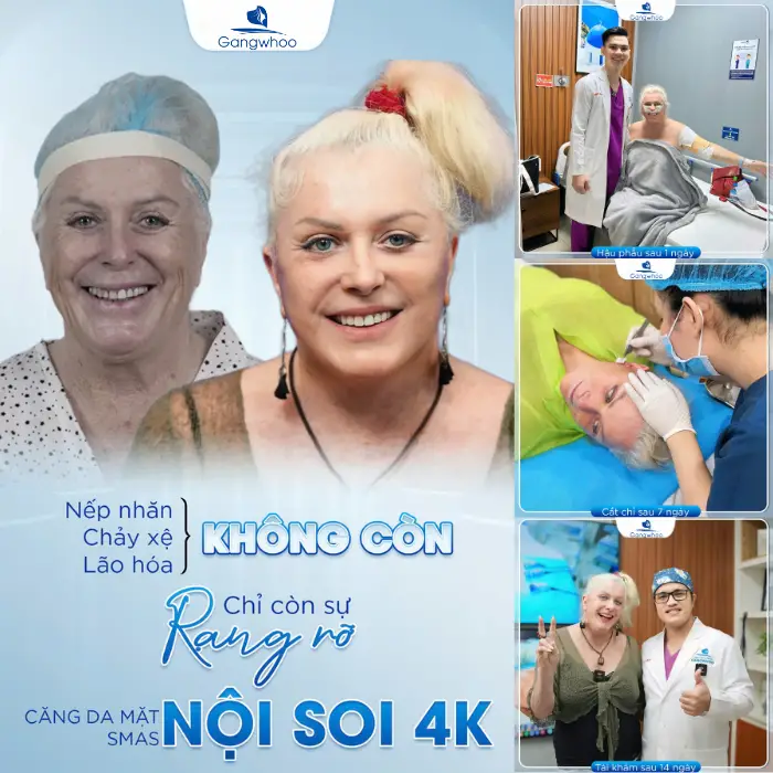 Top 3 Địa Chỉ Nâng Cơ Xóa Nhăn Hàng Đầu Ở TPHCM