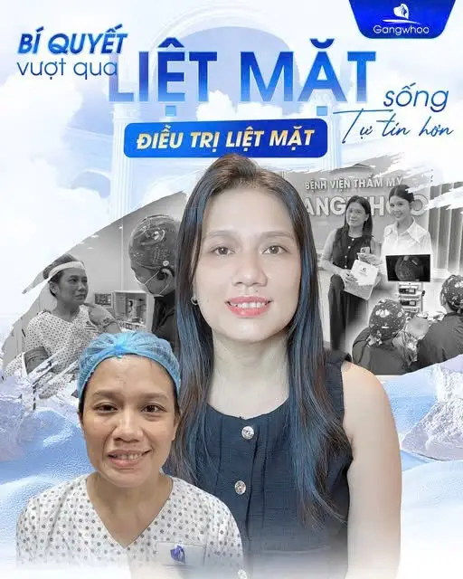 Liệt dây thần kinh số 7 bắt nguồn từ nhiều nguyên nhân