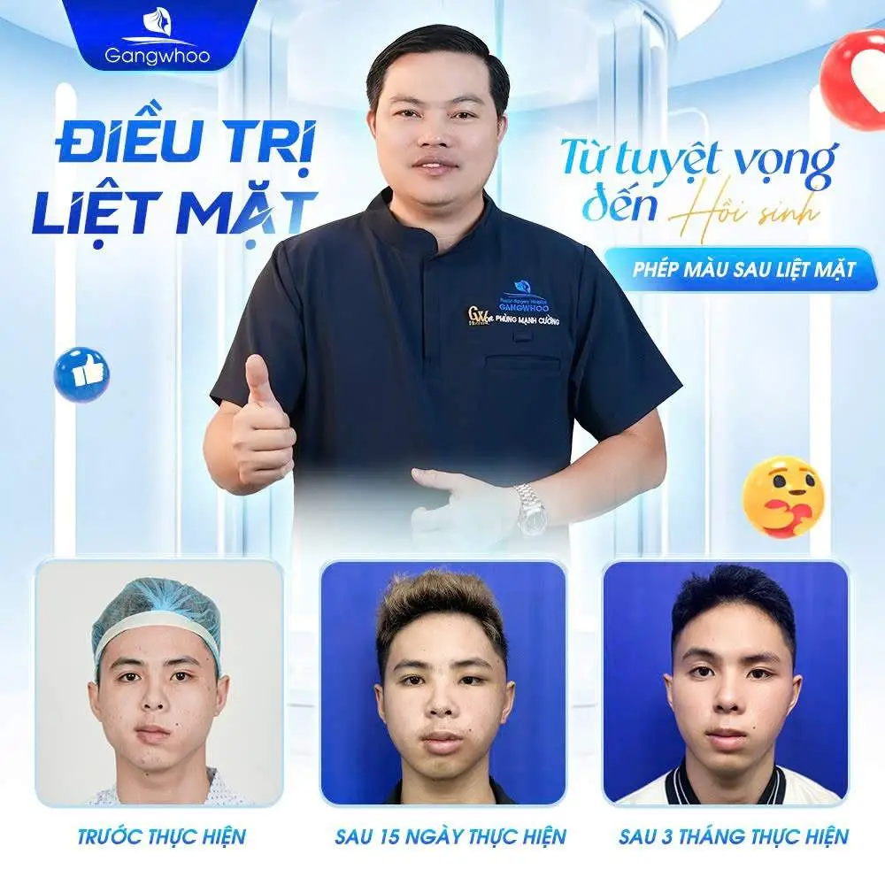 Liệt dây thần kinh số 7 ảnh hưởng nghiêm trọng đến thẩm mỹ