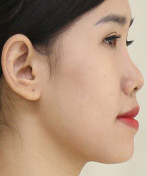 Mũi tẹt là đặc điểm chung của người Việt Nam 