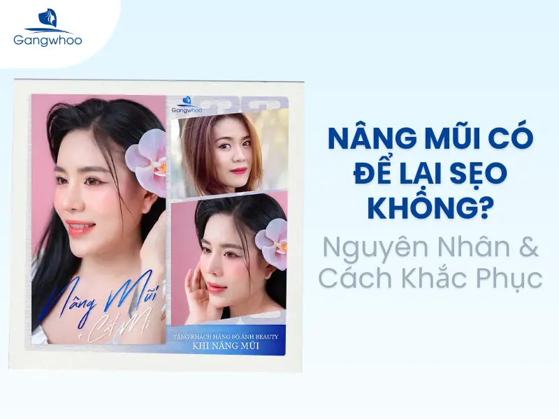 Nâng Mũi Có Để Lại Sẹo Không? Nguyên Nhân & Cách Khắc Phục