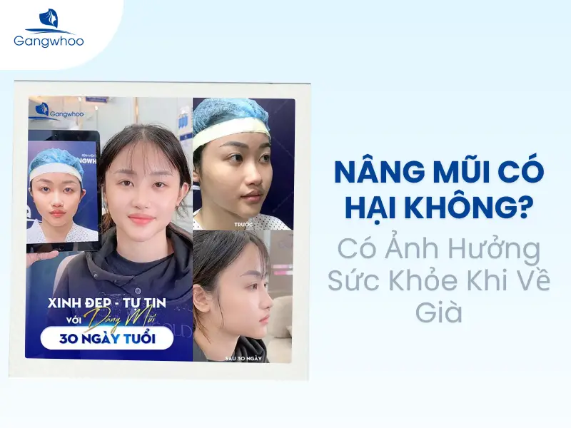 Nâng Mũi Có Hại Không? Ảnh Hưởng Gì Đến Sức Khỏe
