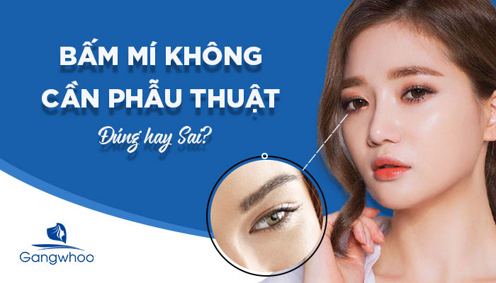 [Giải Đáp] Bấm Mí Không Cần Phẫu Thuật Đúng Hay Sai?