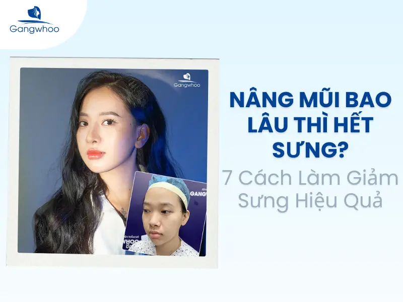 Nâng Mũi Bao Lâu Thì Hết Sưng? 3 Yếu Tố Ảnh Hưởng