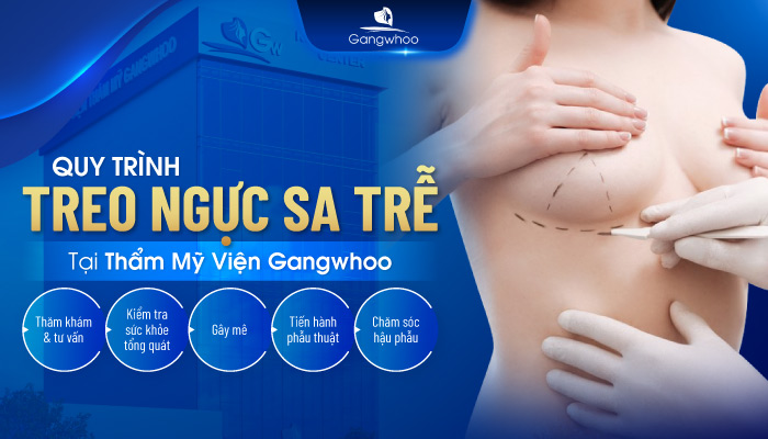 Quy trình treo ngực sa trễ chuẩn Y khoa tại TMV Gangwhoo
