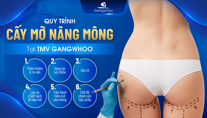 Quy trình cấy mỡ nâng mông tại TMV Gangwhoo