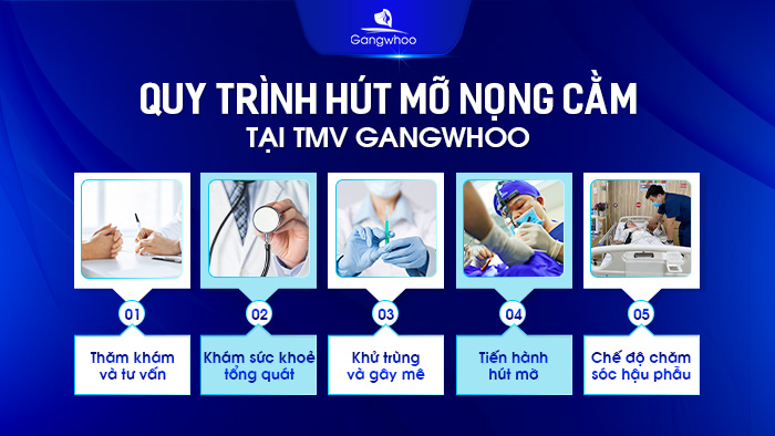Quy trình nâng ngực chuẩn Y khoa tại TMV Gangwhoo