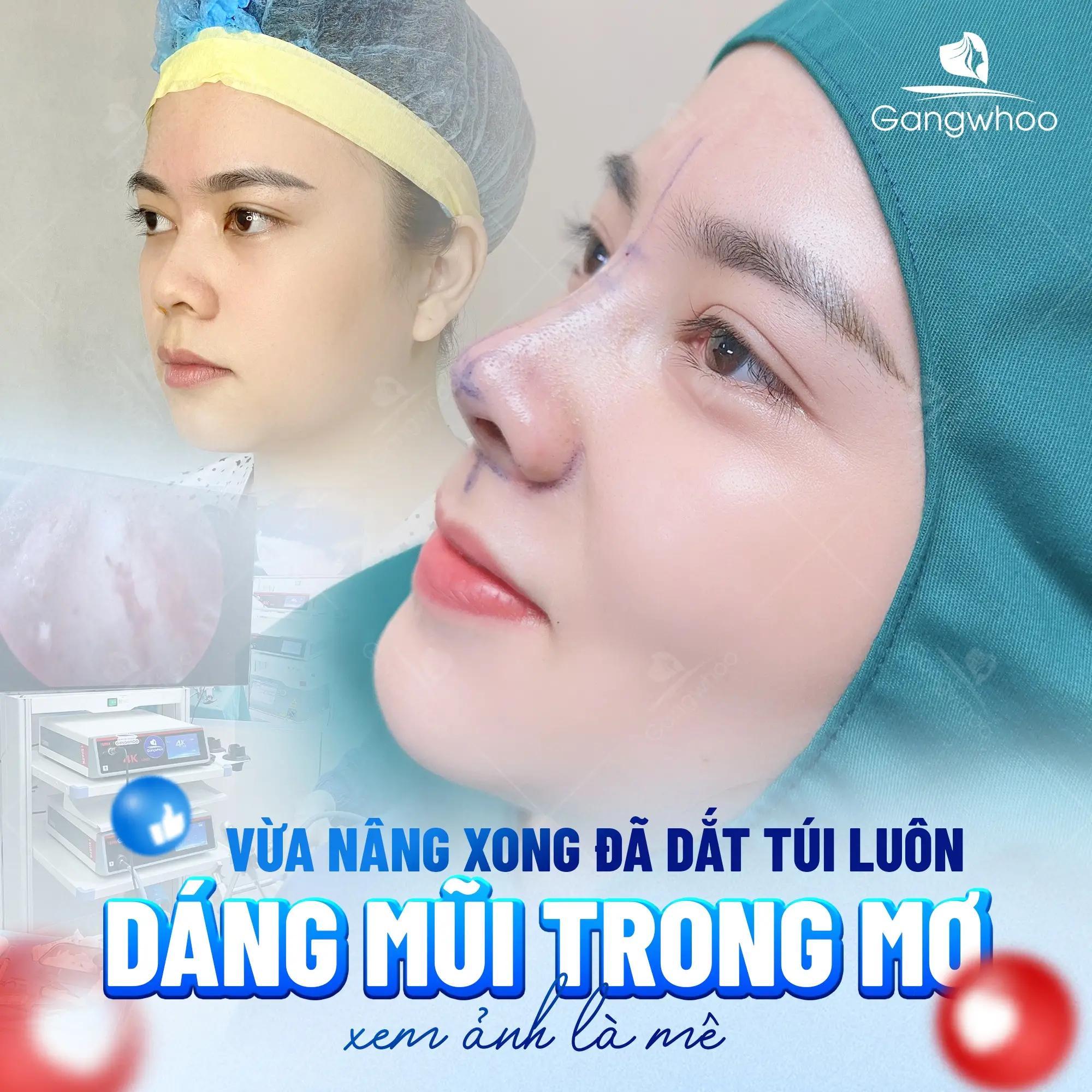 Top 9+ Cách Làm Mũi Cao Lên Tự Nhiên Ngay Tại Nhà Hiệu Quả