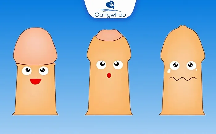 Chọn địa chỉ cắt bao quy đầu an toàn, uy tín