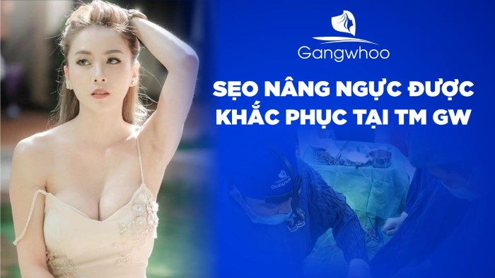 Quyến rũ, tự tin - không phải lo về sẹo nâng ngực sau khi đến "Gangwhoo"