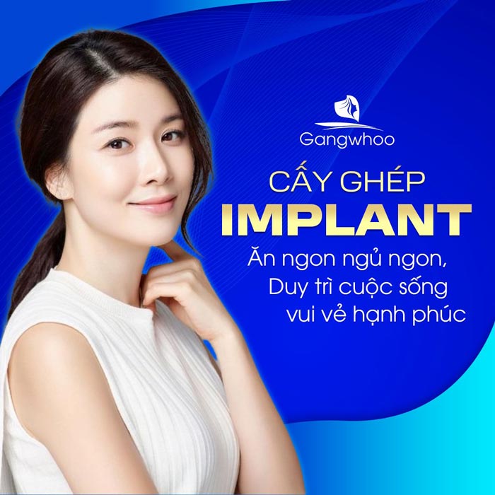 Quy Trình Thực Hiện Cấy Ghép Implant Mất Bao Lâu? 4