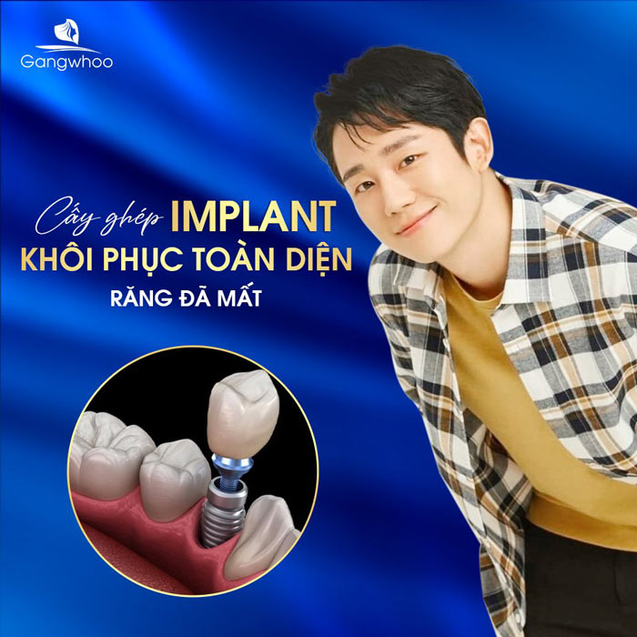 Quy Trình Cấy Ghép Implant Tức Thì Ngay Sau Khi Mất Răng 3