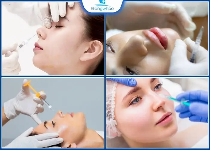 Tiêm Filler Mũi Giữ Được Bao Lâu? Bí Quyết Duy Trì Lâu Dài