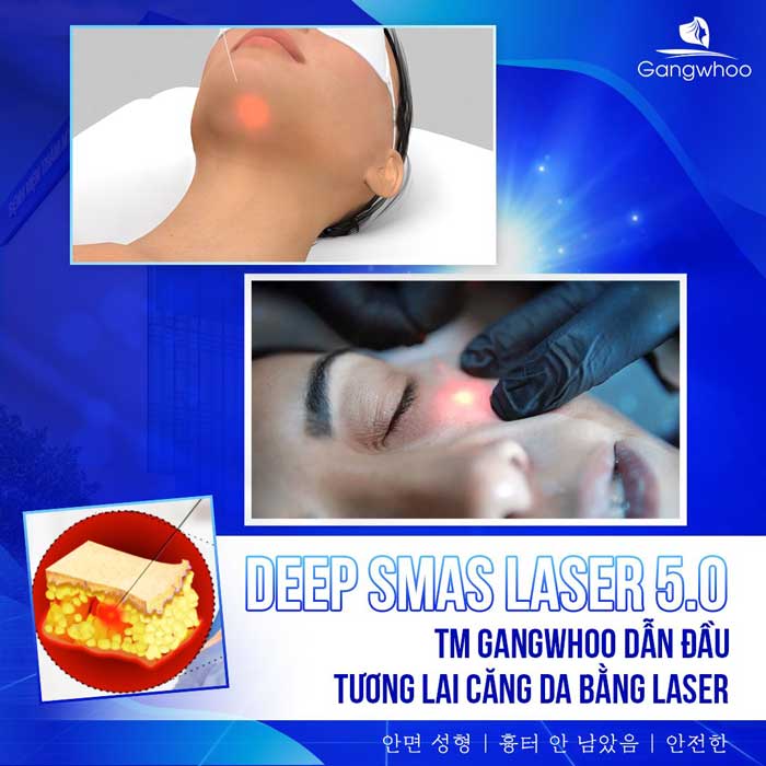 Căng Da Mặt Deep Smas Laser 5.0 – Đỉnh Cao Công Nghệ Trẻ Hoá Không Phẫu Thuật 1