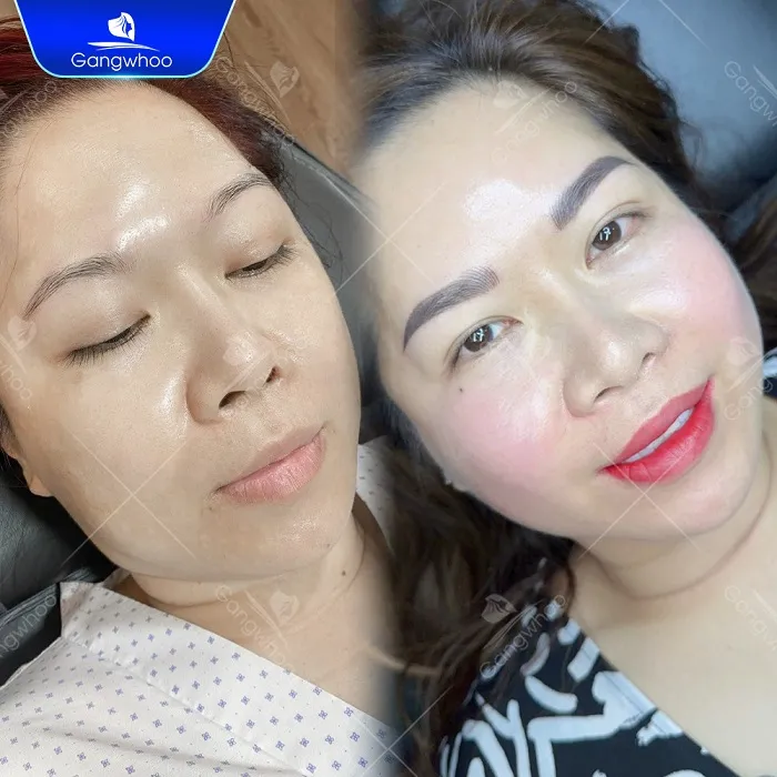 Hướng dẫn chăm sóc sau khi thực hiện phun xăm môi thẩm mỹ