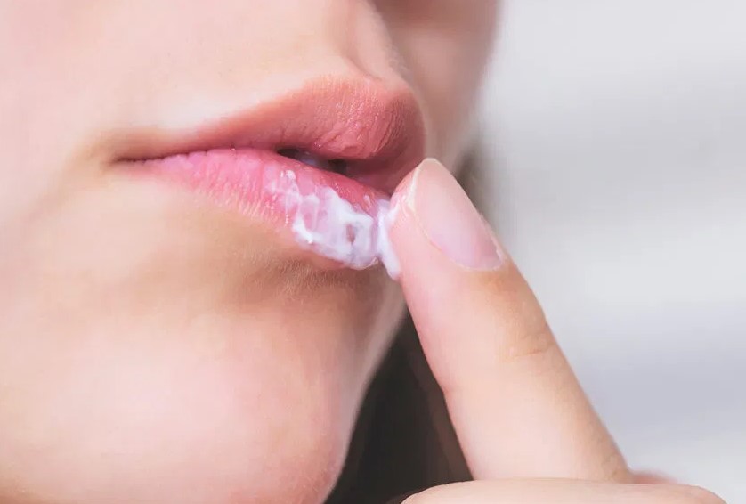 Thuốc Acyclovir được bào chế dưới dạng kem bôi thường được chỉ định sử dụng sau khi phun môi