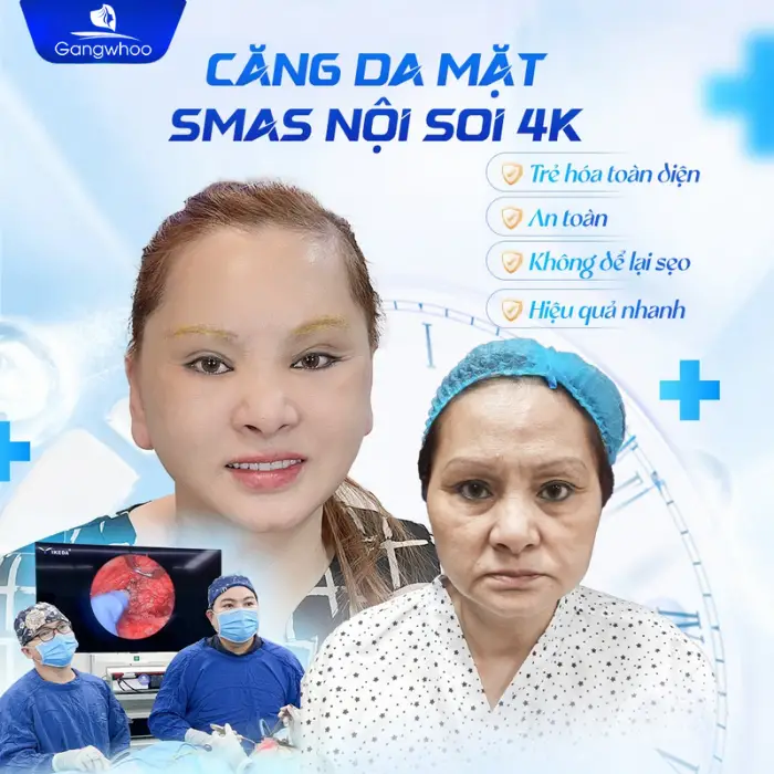 Căng Da Mặt Giá Bao Nhiêu? Bảng Giá Cập Nhật 2025