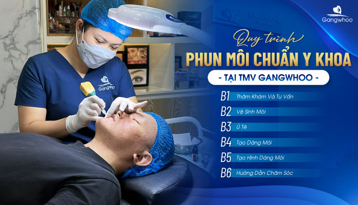 Quy trình phun môi chuẩn Y khoa tại TMV Gangwhoo
