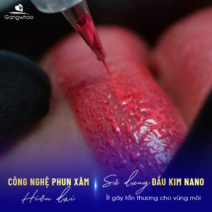 Phun môi nano dùng đầu kim siêu nhỏ để thẩm thấu màu mực lên lớp da trên cùng của môi